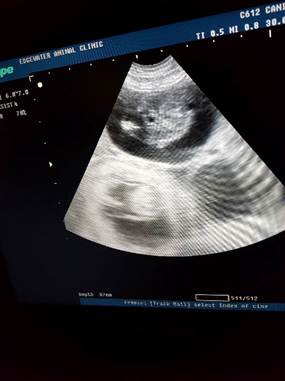 A ultrasound image of a baby

Description automatically generated